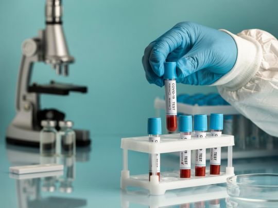 Peptide Purity